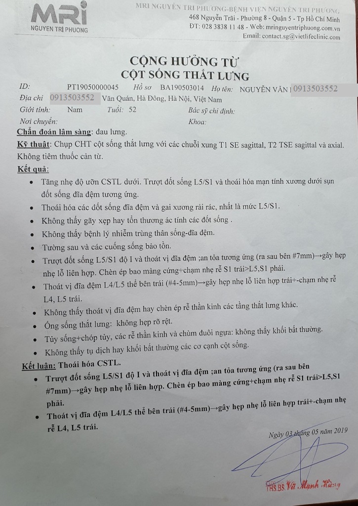 Thoát vị đĩa đêm lưng